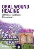 Oral Wound Healing: Cell Biology and Clinical Management