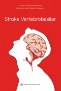 Stroke vertebrobasilar