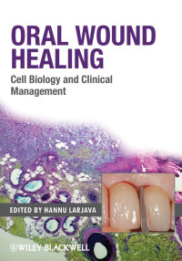 Image of Oral Wound Healing: Cell Biology and Clinical Management