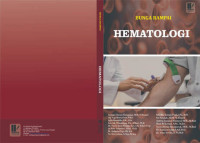 Image of Bunga rampai hematologi