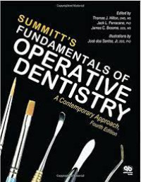 Image of Summitt's Fundamentals of Operative Dentistry: A Contemporary Approach